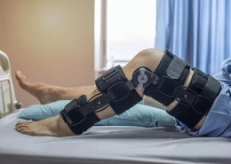 دوره نقاهت بعد از عمل رباط صلیبی