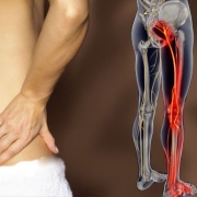 علائم دیسک کمر در پاها