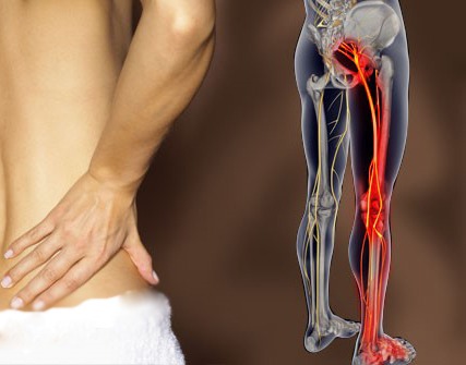 علائم دیسک کمر در پاها